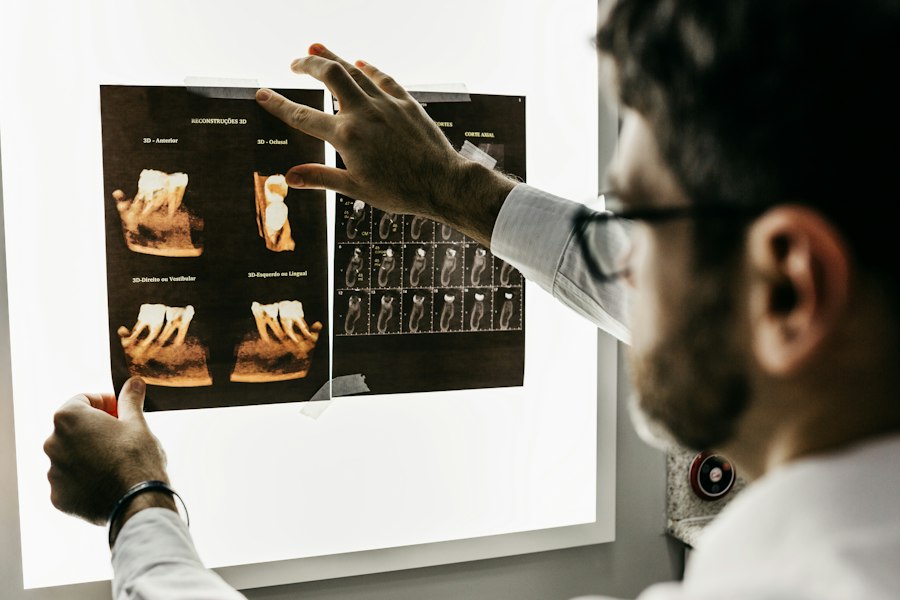 Implantes dentales