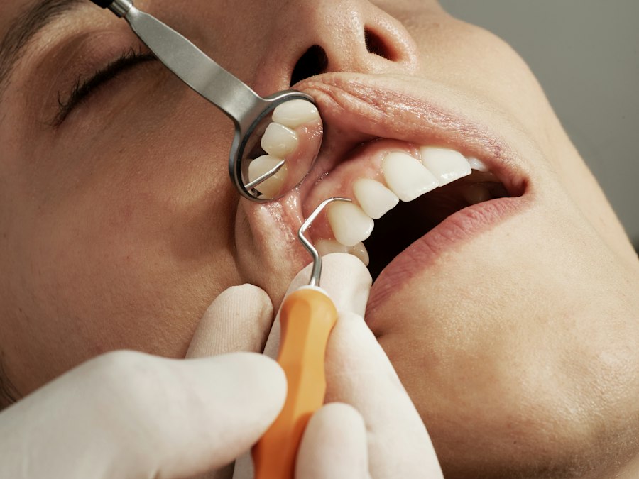 Limpieza dental profesional